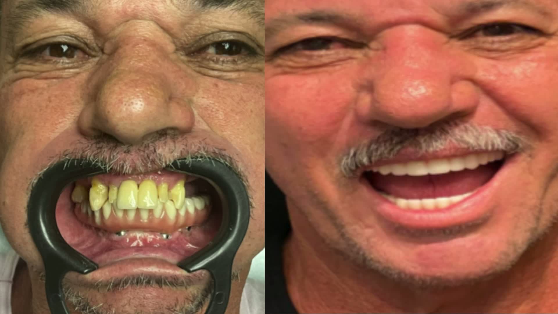 Caso clínico — antes e depois 3